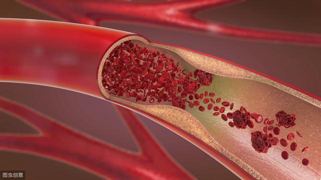 避孕贴 血块_避孕贴不规则出血_避孕贴出血