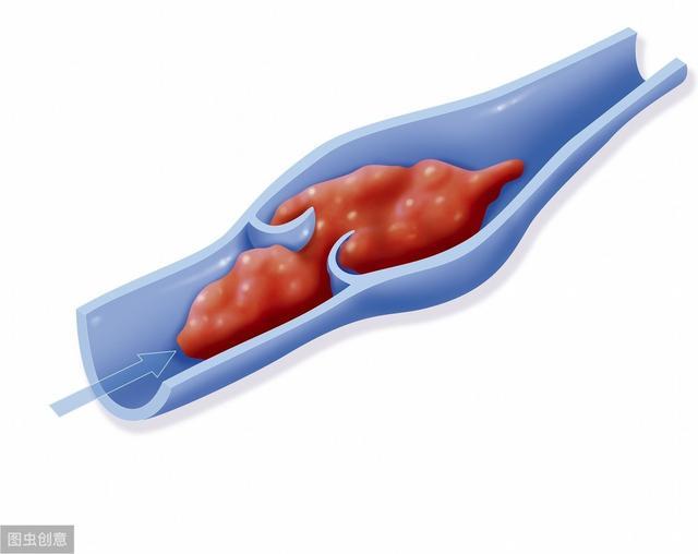 避孕贴不规则出血_避孕贴出血_避孕贴 血块