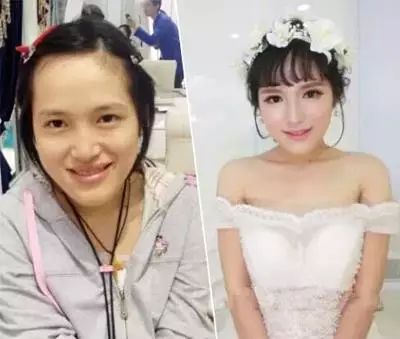 避孕贴脱落_避孕贴 血块_避孕贴不规则出血