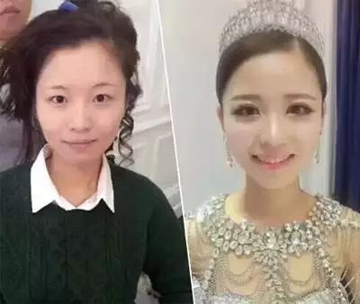 避孕贴不规则出血_避孕贴脱落_避孕贴 血块