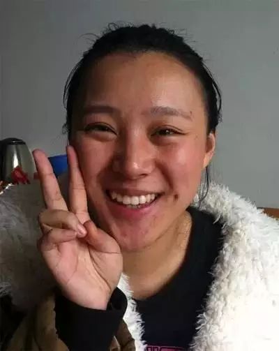 避孕贴不规则出血_避孕贴 血块_避孕贴脱落