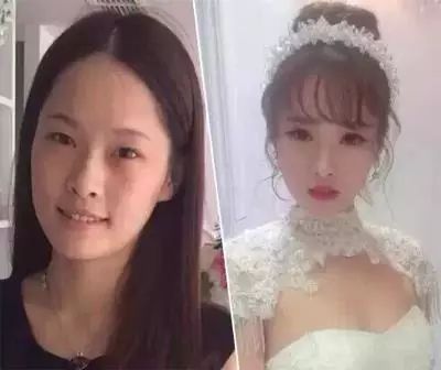 避孕贴脱落_避孕贴不规则出血_避孕贴 血块