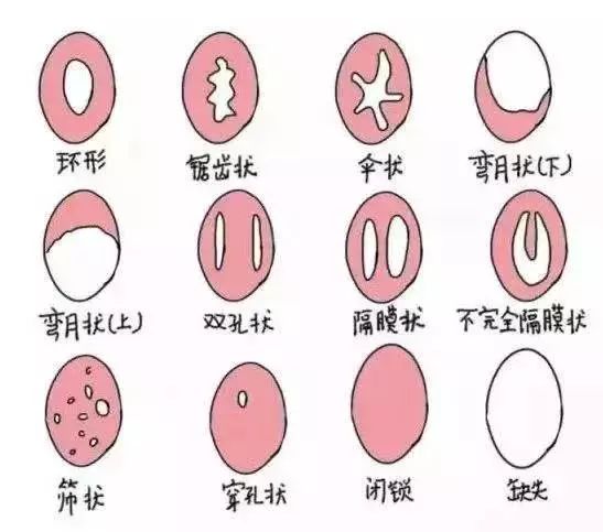 避孕贴可以贴同一个地方吗_贴避孕_贴避孕地方可以同房吗