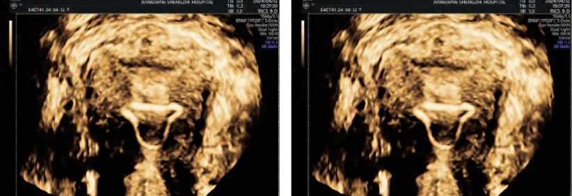 贴避孕贴后月经淋漓不尽_避孕贴 血块_贴避孕贴流血不止