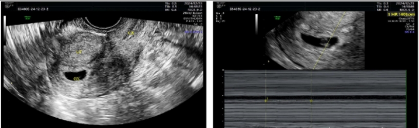 贴避孕贴流血不止_避孕贴 血块_贴避孕贴后月经淋漓不尽