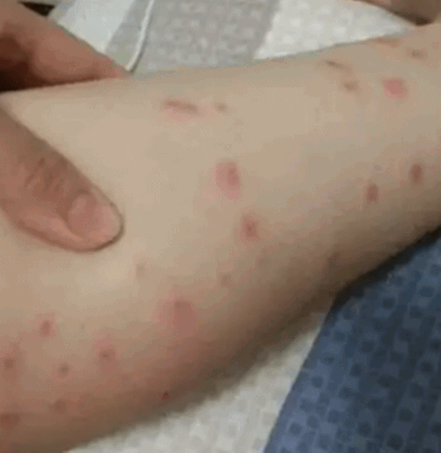 烟雾机_烟雾机的故障与维修_烟雾机打药效果怎么样