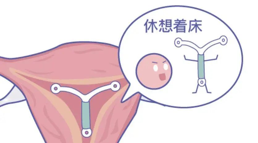贴避孕贴可以喝酒吗_贴避孕贴会怀孕吗_避孕贴怎么贴
