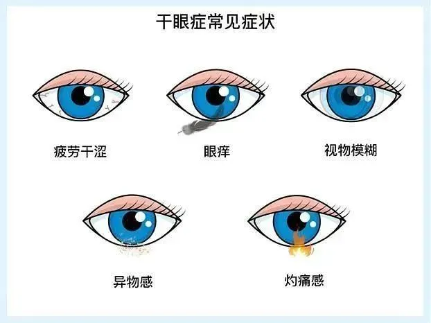 融合中西医智慧，干眼症治疗之路更“润”畅__融合中西医智慧，干眼症治疗之路更“润”畅