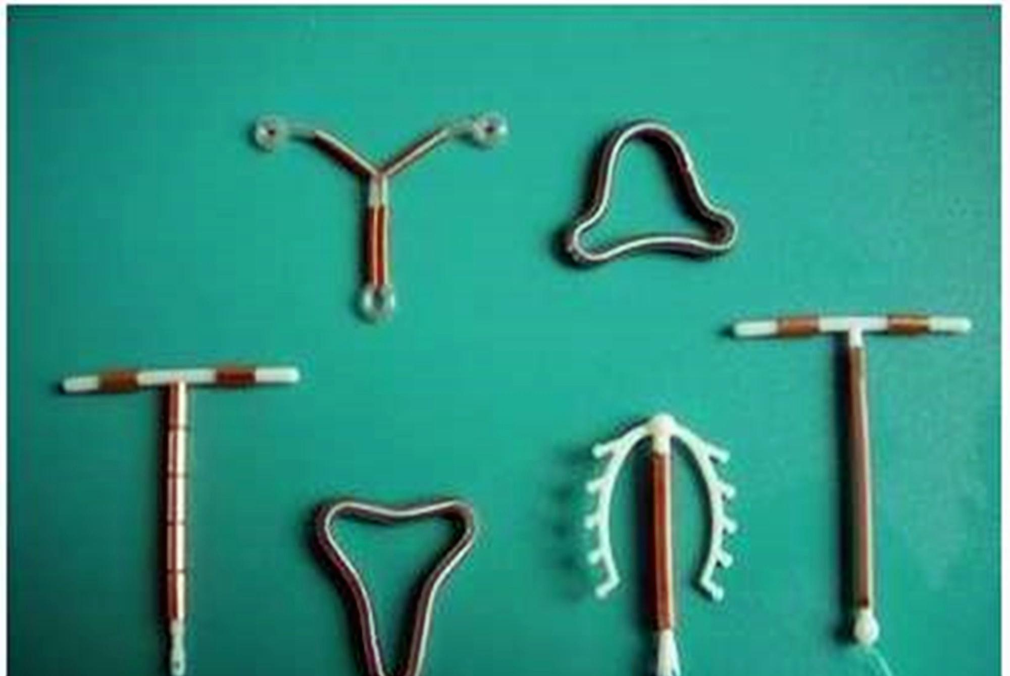 节育环历史与影响_避孕贴可以立即生效吗_土爸育儿经验