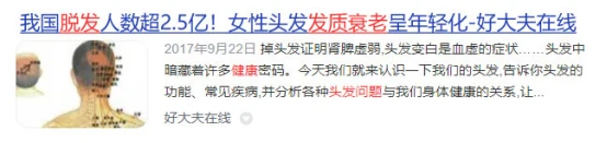 卷发棒测评推荐_什么卷发棒好用不伤发_不伤发卷发棒排名