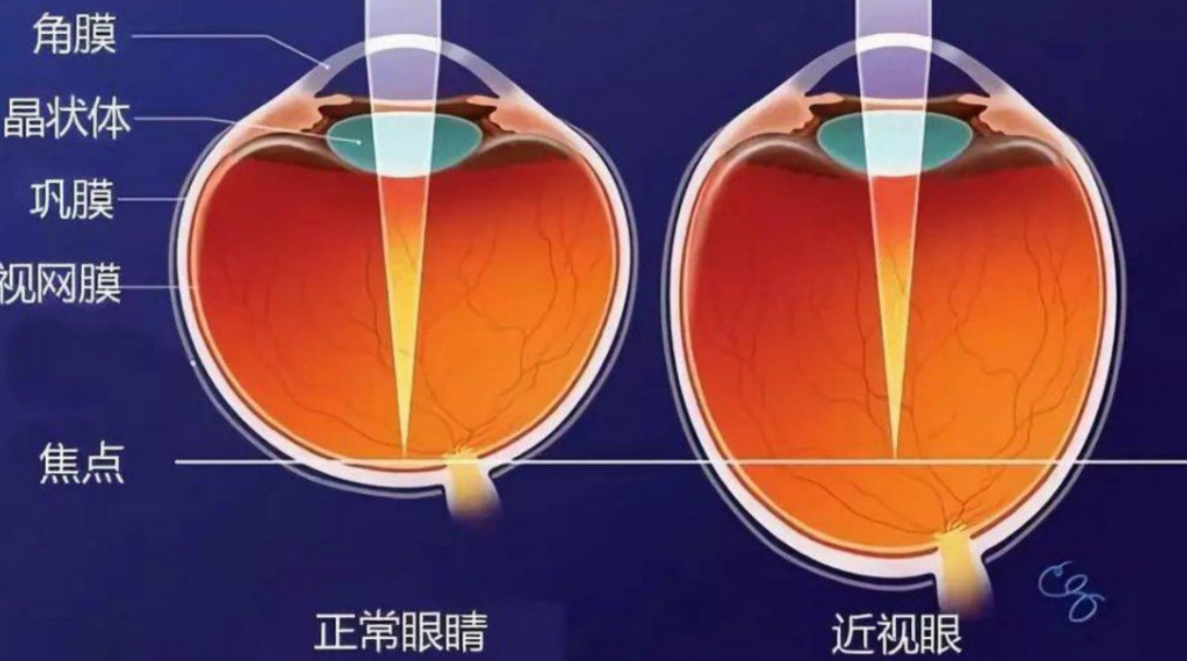 高品质LED大路灯推荐_大路灯护眼测评_大路灯如何使用