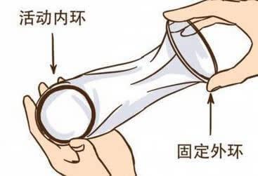 宫内节育器避孕比例_女性避孕方式统计_避孕贴多久可以行房