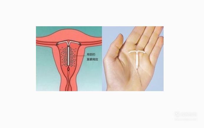 女性避孕药副作用_安全避孕方法_避孕贴怎么贴