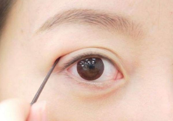 避孕贴怎么贴_双眼皮贴修剪技巧_双眼皮贴贴法教程