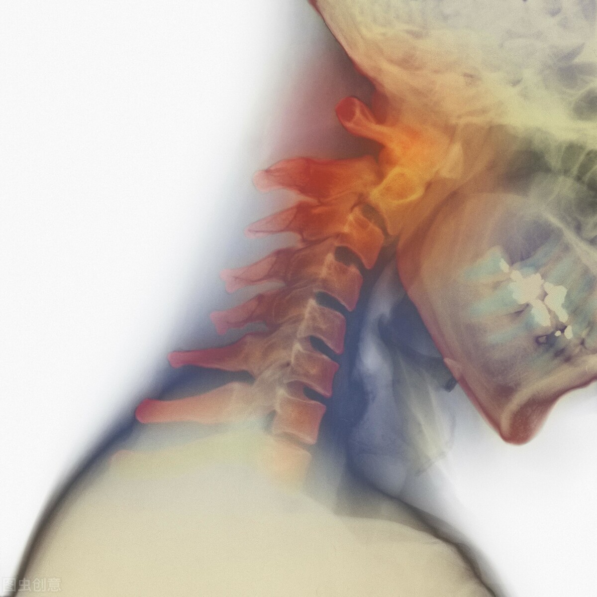 颈椎病症状诊断_交感型颈椎病治疗_头晕恶心出虚汗颈椎病