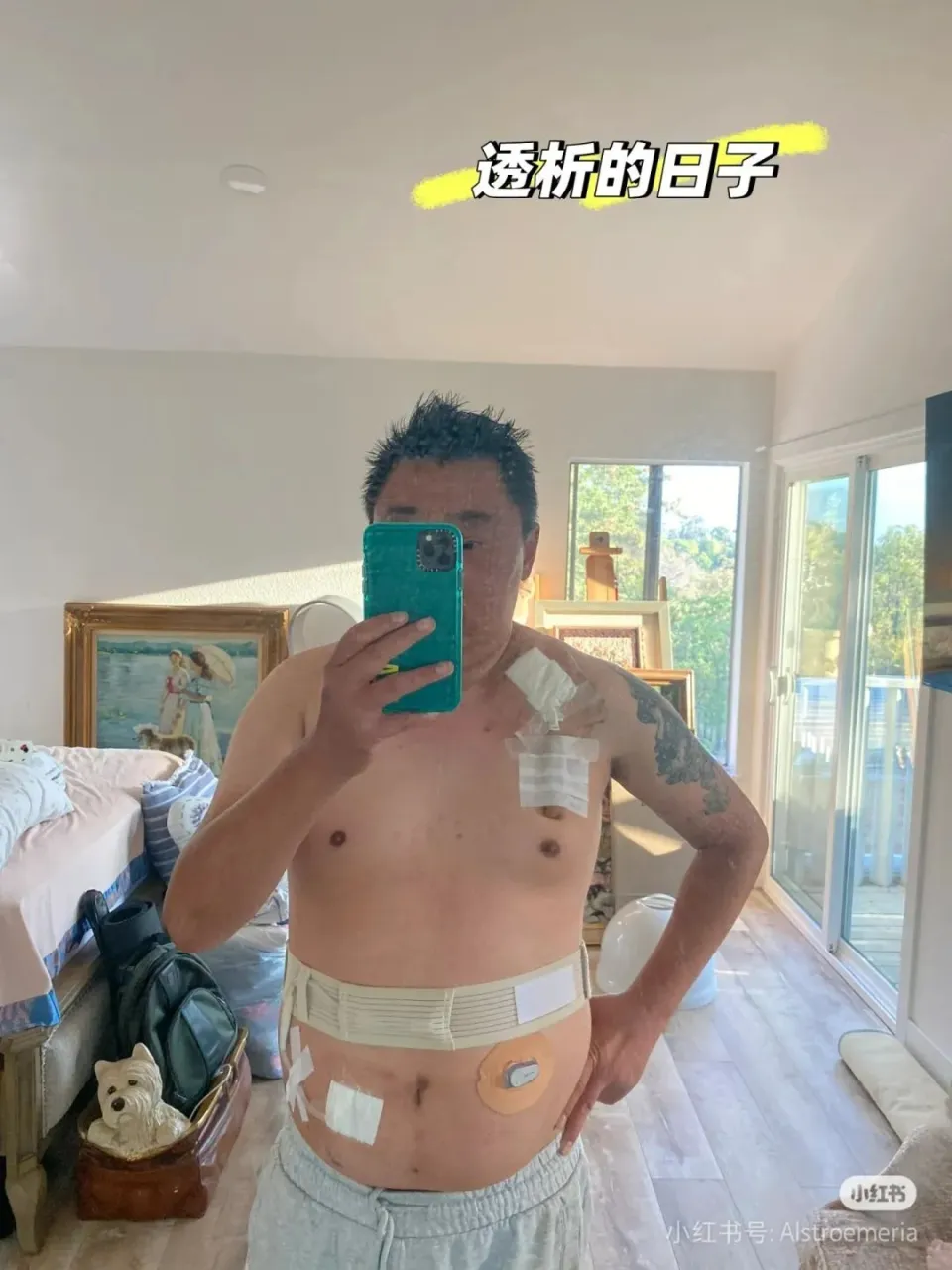糖尿病最后的结局_糖尿病结局很惨吗_