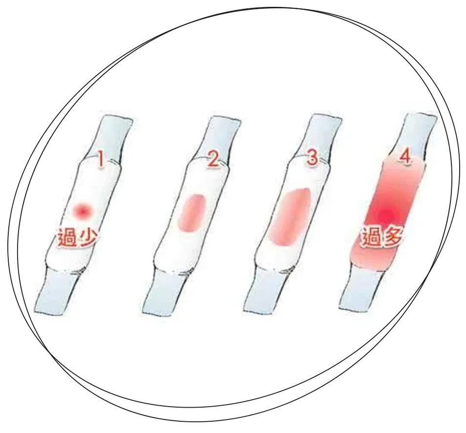 避孕贴跟避孕药_天南地北大拜年_易孕体质