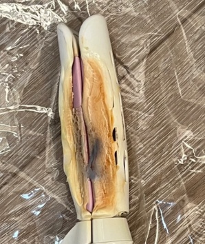 卷发棒温度_卷发棒安全使用注意事项_卷发棒火灾预防方法