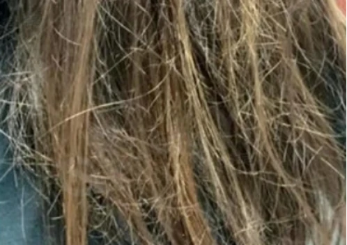 卷发棒经常用伤头发吗_ 优质卷发棒选购技巧 _卷发棒伤发危害分析