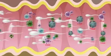 液体避孕套避孕效果_避孕贴厂家_安全期避孕失败率