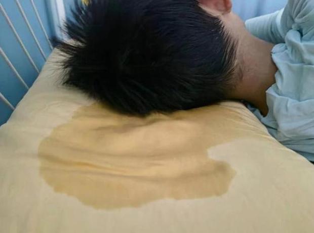 出汗多是否肾虚_出汗多原因分析_睡觉出虚汗怎么回事