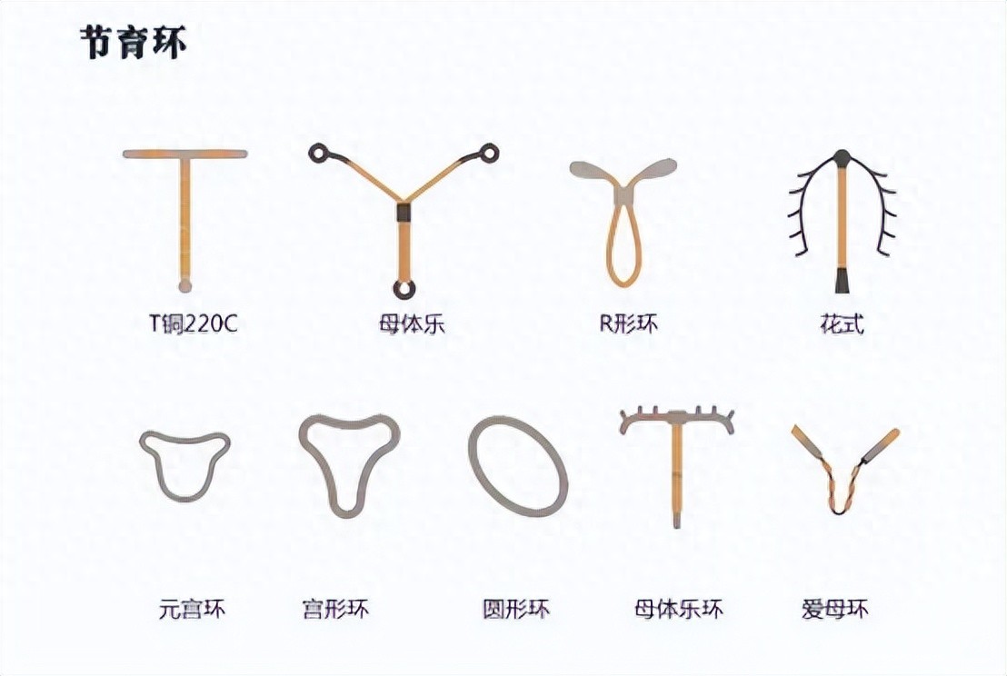 节育环前世今生_避孕贴怎么用_上环避孕方式