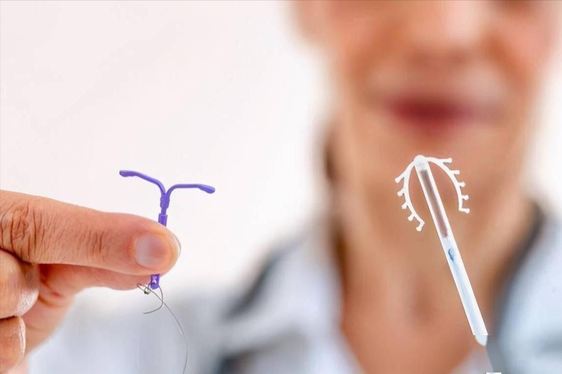 宫内节育器放置过程_放置节育环注意事项_避孕贴怎么用