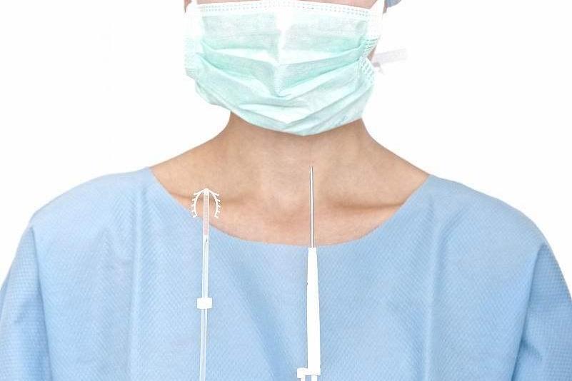 避孕贴怎么用_放置节育环注意事项_宫内节育器放置过程