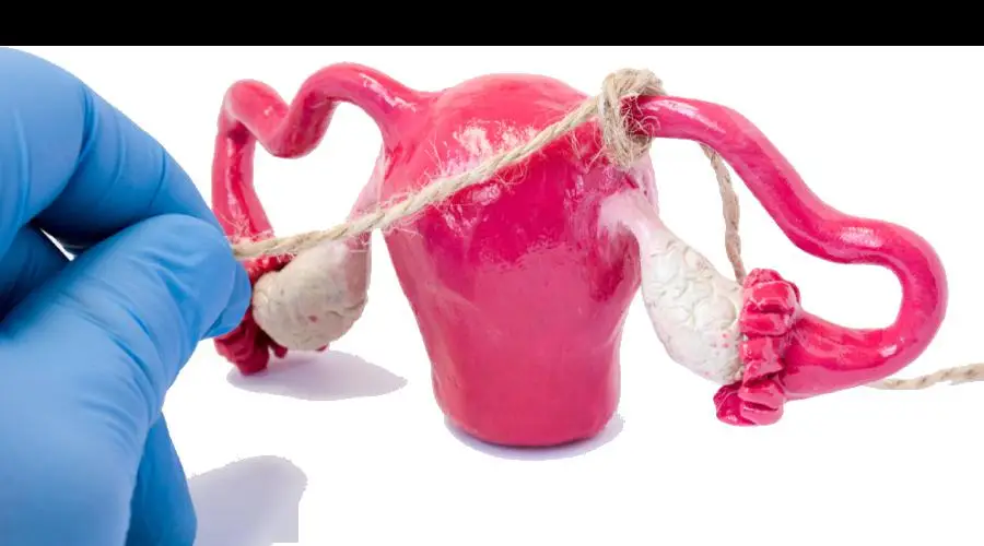 女性避孕方法推荐_避孕方式选择_避孕贴