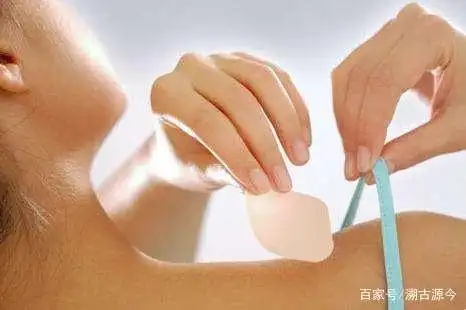 微针避孕贴片_避孕贴可以立即生效吗_长效避孕贴片