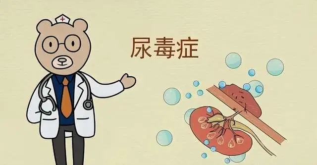 尿毒症透析能治好_尿毒症换了肾能痊愈吗_