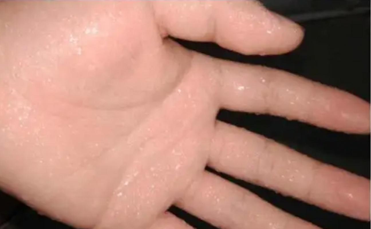 半夜突然出汗_动不动就出汗_出虚汗是阴虚还是阳虚