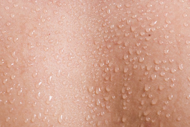 异常出汗症状_夜汗自汗盗汗区别_身上出虚汗怎么回事