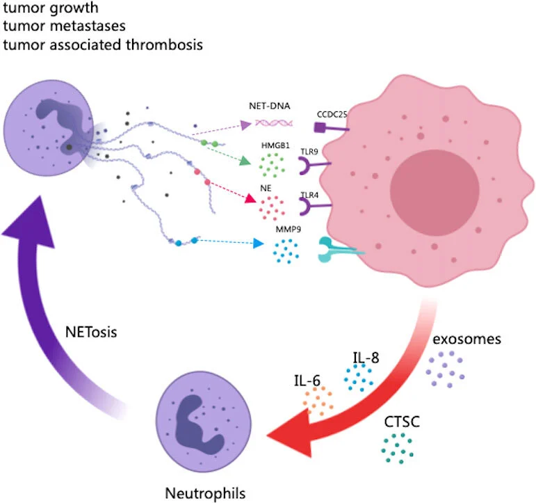 _癌转移免疫疗法有用吗_癌症免疫科学促癌转移手术方案
