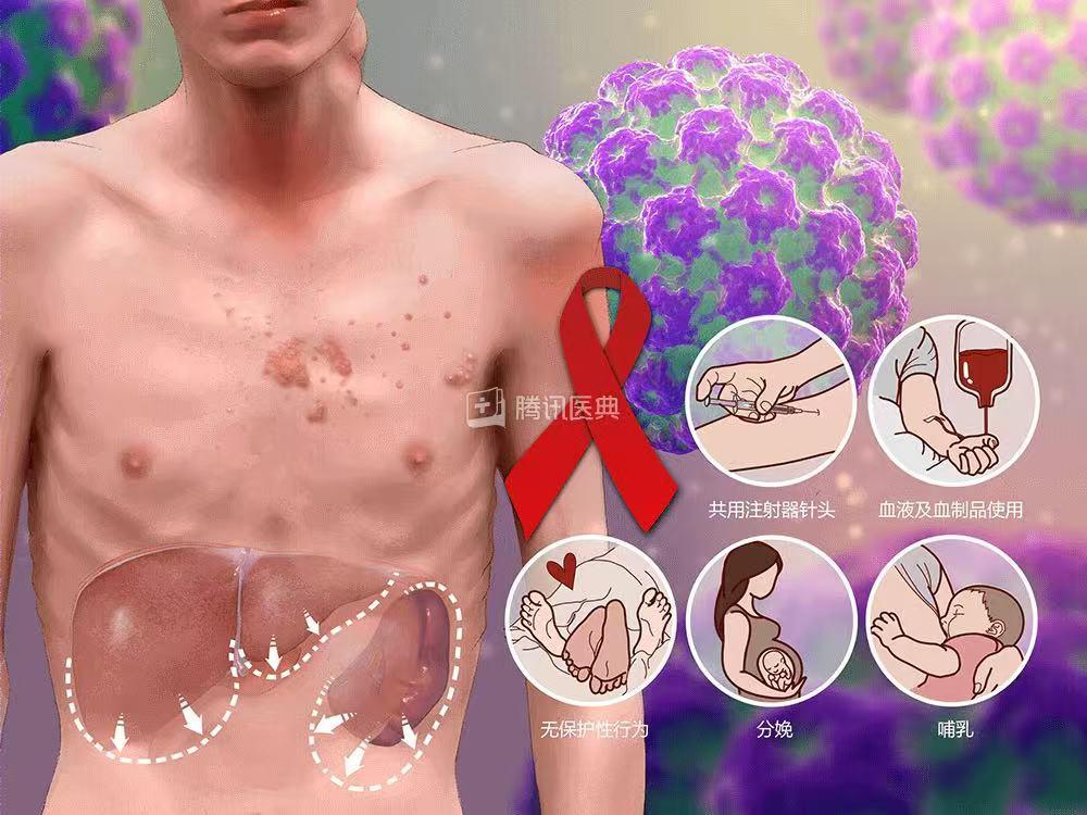 全程戴套安全套使用方法_中途戴套避孕失败率_避孕贴厂家