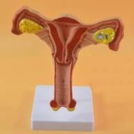 痛经原因及治疗_判断痛经类型_痛经出虚汗