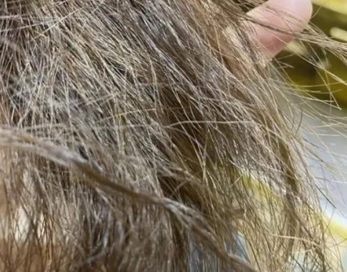 卷发棒伤害发质风险_卷发棒伤头发吗图片_劣质卷发棒潜在危害