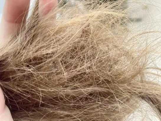 蛋卷卷发棒好处_卷发棒有什么用_劣质卷发棒危害