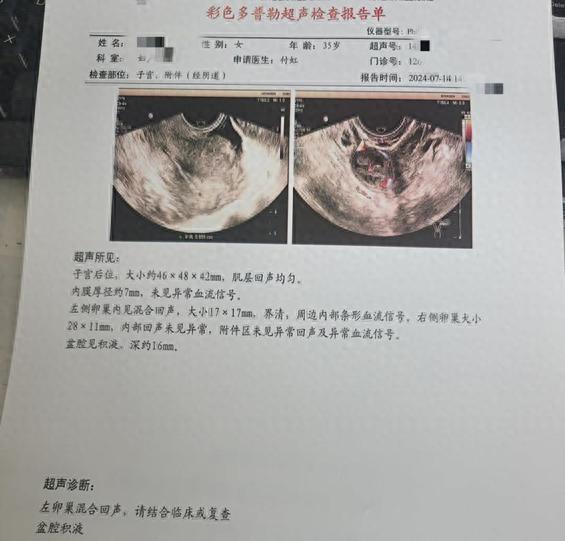 口服紧急避孕药后出血_避孕贴多久可以行房_紧急避孕药不良反应