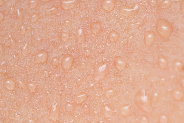 晚上睡觉出虚汗_多汗类型_异常多汗中医调理