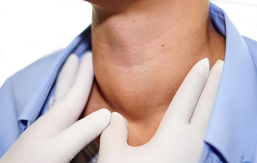 女人出虚汗的原因_多汗原因_异常出汗