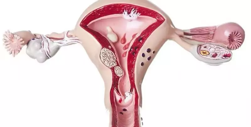 避孕贴怎么用_古代皇帝堕胎药未奏效而生_古代皇室避孕方法