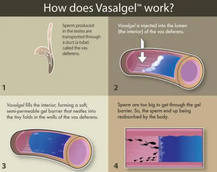男性避孕药_避孕贴怎么用_男性节育技术