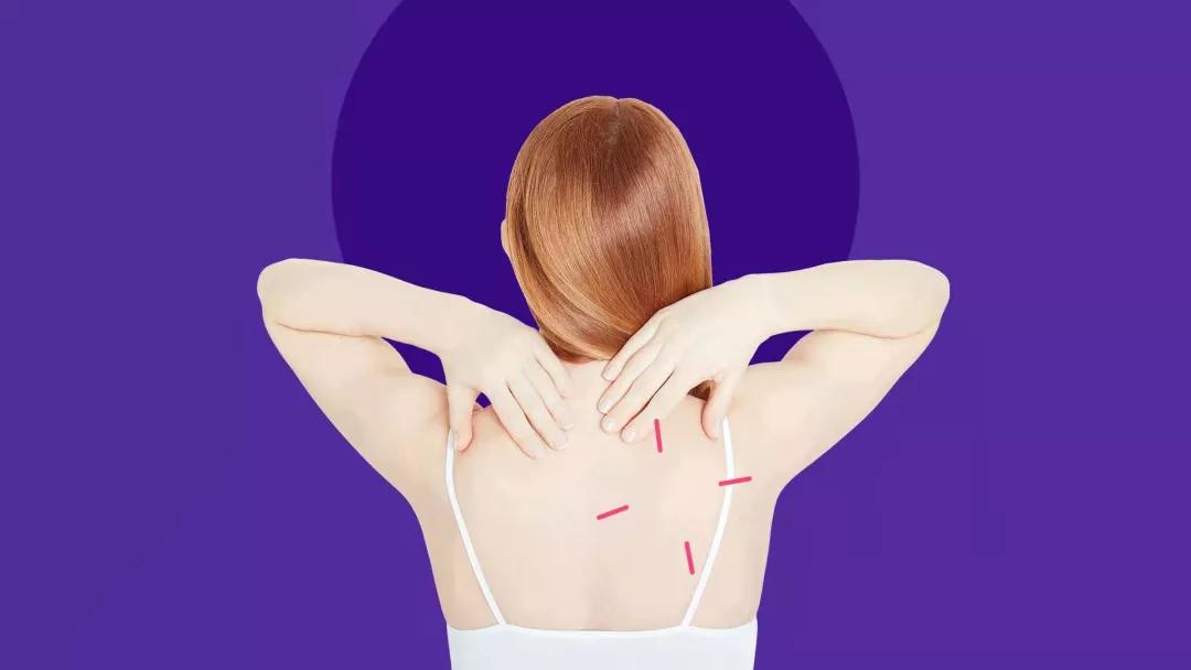 透皮避孕贴_避孕贴可以贴同一个地方吗_女用避孕贴