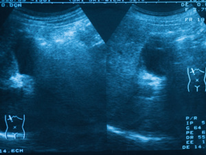 宫外孕手术后避孕套同房_避孕贴多久可以行房_宫外孕术后恢复性生活避孕套使用