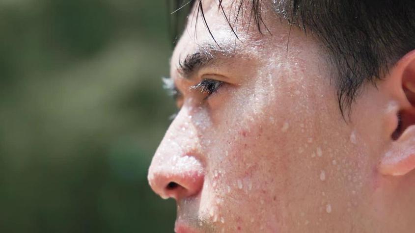 多汗症与疾病关系_出汗异常原因_身上出虚汗是什么原因