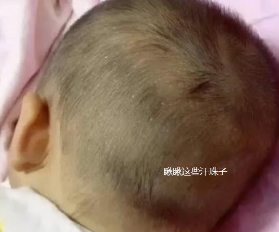 宝宝脖子处出虚汗怎么回事_孩子睡觉出汗原因_孩子睡觉头部颈部出汗怎么办